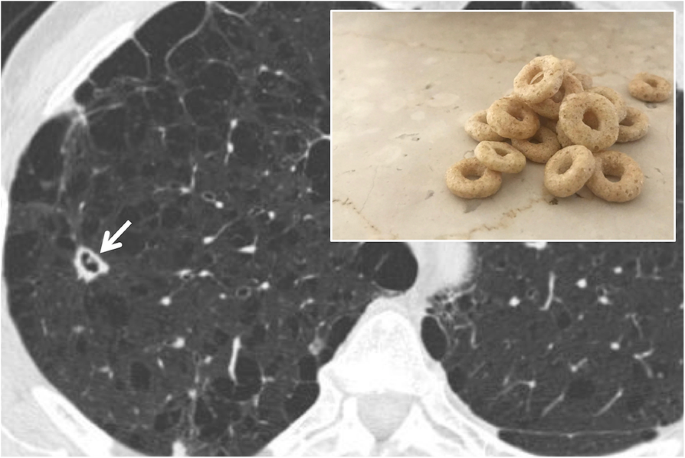 визуализации заболеваний грудной клетки