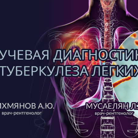 Лучевая диагностика туберкулеза легких