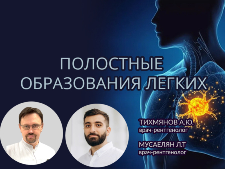 Полость распада в легком