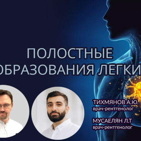 Полость распада в легком