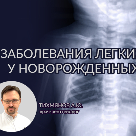 Заболевания легких у новорожденных